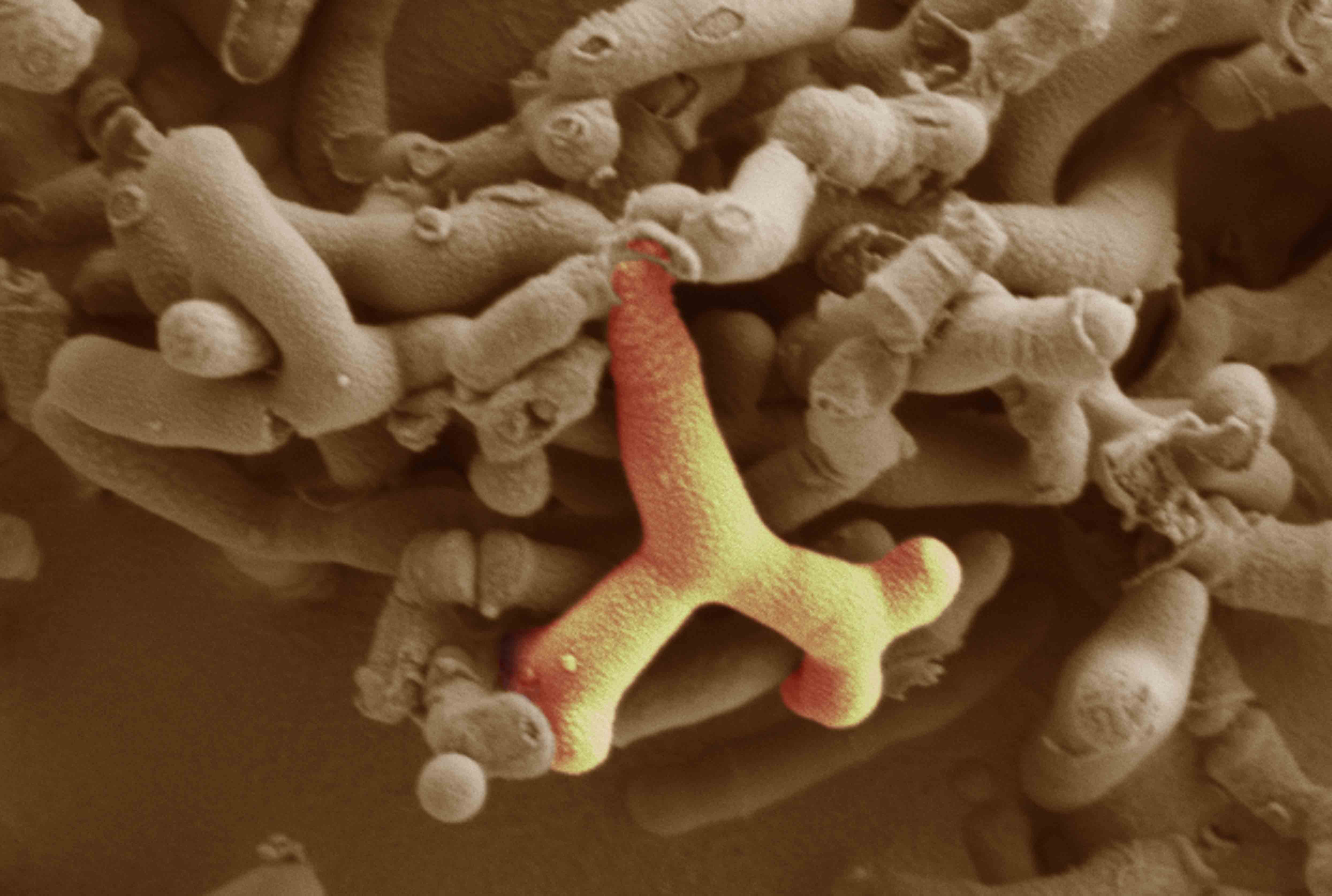 Electron micrograph of bifidobacterium